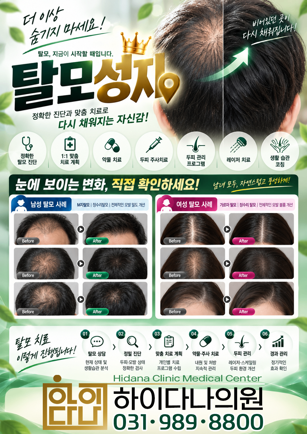 광고_탈모성지.png